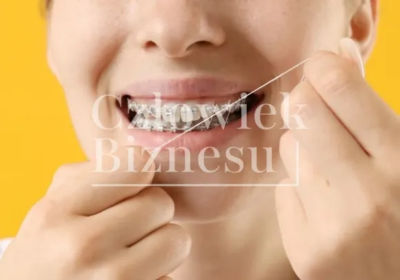 Jak dbać o czystość zamków ortodontycznych po posiłku?
