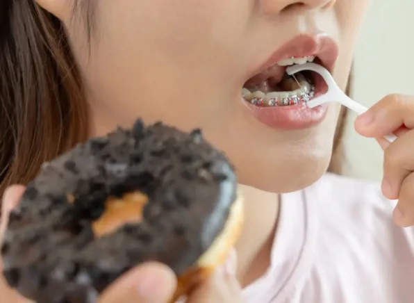 Jak szczotkować zęby z aparatem, aby robić to naprawdę skutecznie?