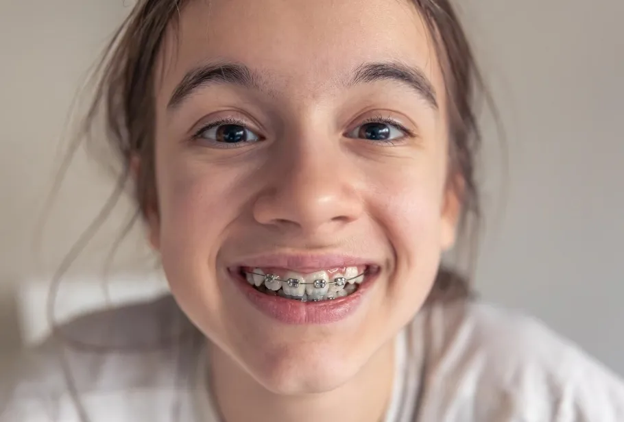 Jak rozpoznać, że aparat ortodontyczny rani jamę ustną dziecka?