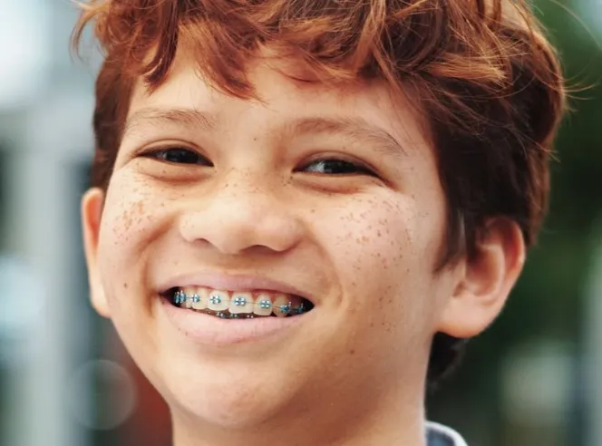 Jak wspierać dziecko emocjonalnie podczas leczenia ortodontycznego?